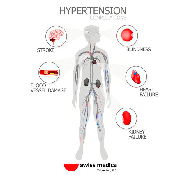 Complications from uncontrolled high blood pressure